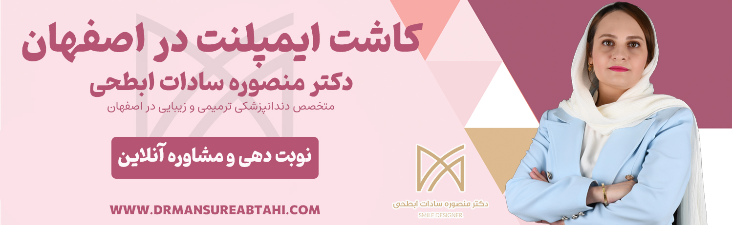 کاشت ایمپلنت در اصفهان