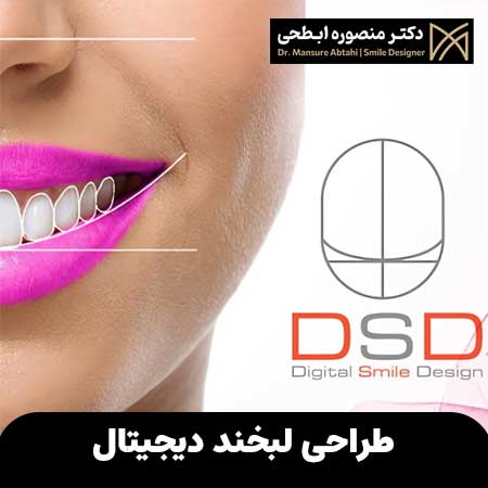 طراحی لبخند دیجیتال اصفهان