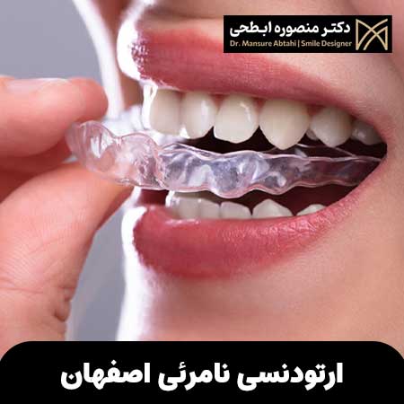 ارتودنسی نامرئی اصفهان| بدون سیم وبراکت