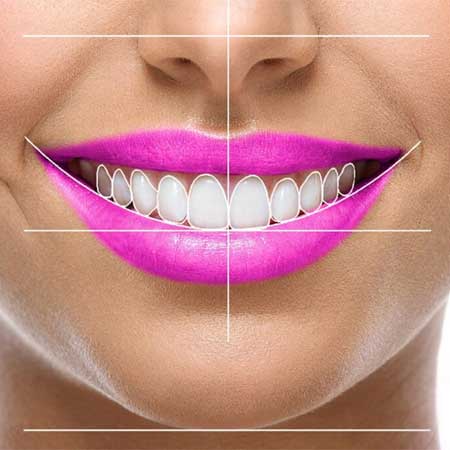 اصلاح طرح لبخند در اصفهان