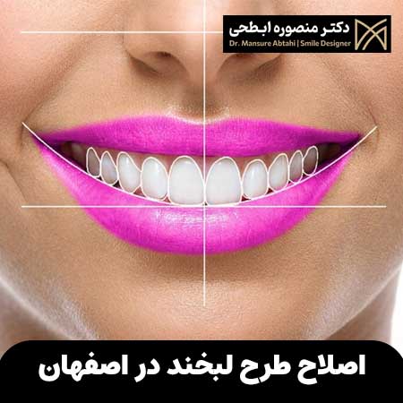 اصلاح طرح لبخند در اصفهان
