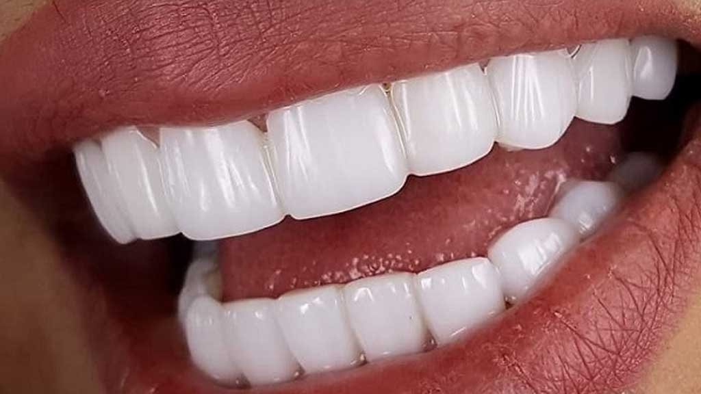 برند کامپوزیت ای پی اس در اصفهان