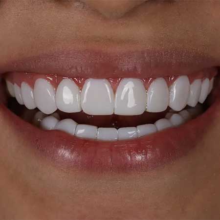 کامپوزیت کاریزما آلمان در اصفهان