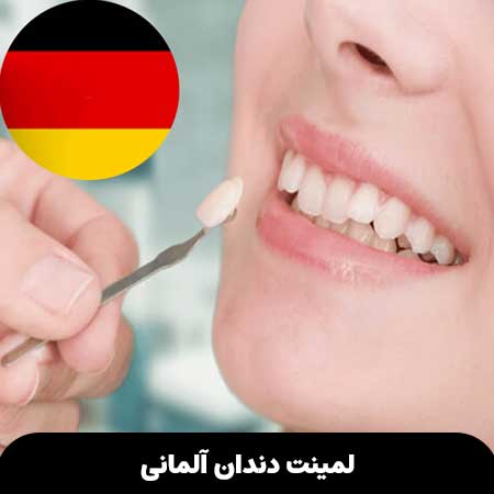 لمینت دندان آلمانی