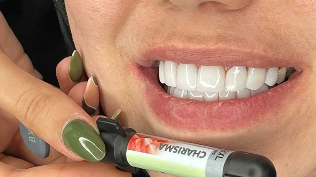 بهترین برند کامپوزیت کاریزما در اصفهان کدام است؟