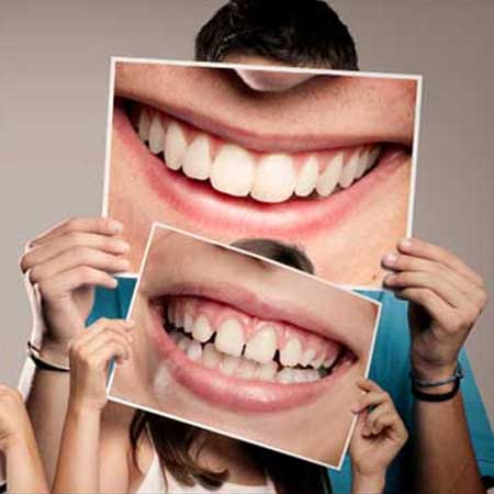 ایا کامپوزیت محدودیت سنی دارد؟