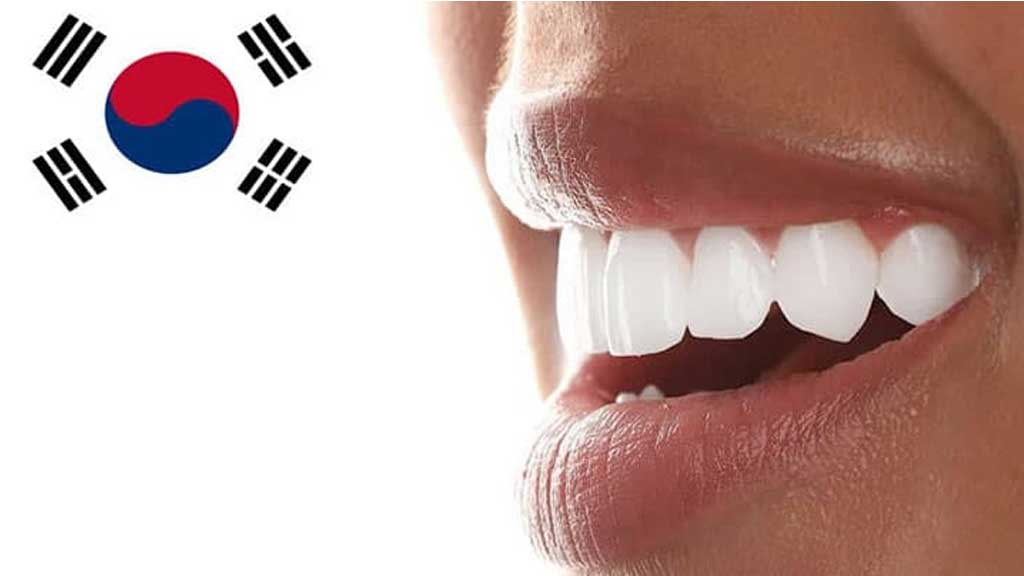 قیمت لمینت کره ای در اصفهان