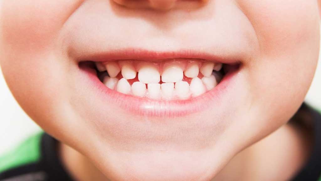 کامپوزیت برای چه سنی مناسب است؟