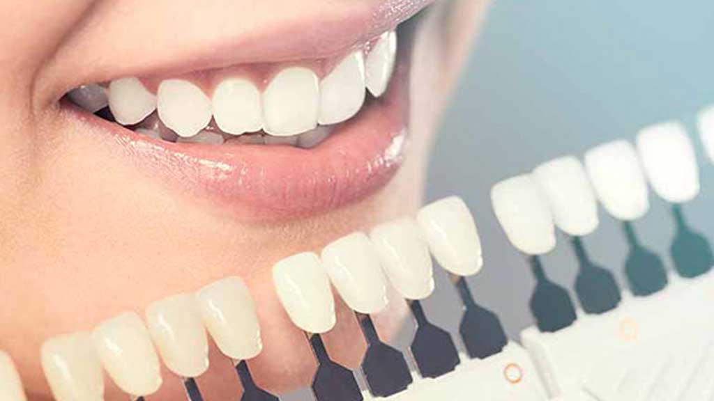 کامپوزیت سارمکو سوئیسی در اصفهان