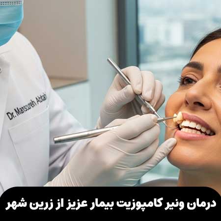 درمان ونیر کامپوزیت بیمار عزیز از زرین شهر