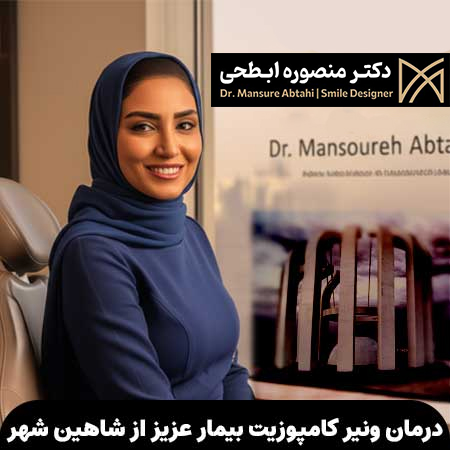 درمان ونیر کامپوزیت بیمار عزیز از شاهین شهر