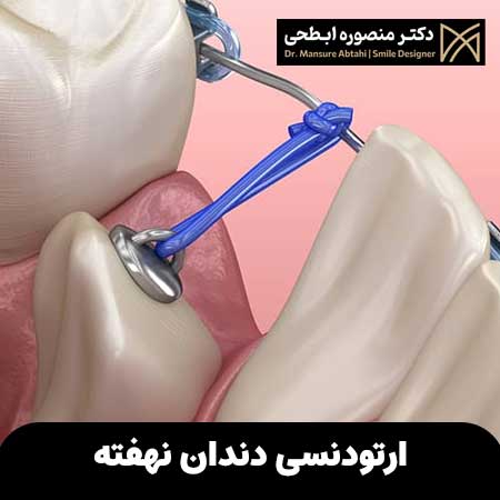 ارتودنسی دندان نهفته چگونه است؟