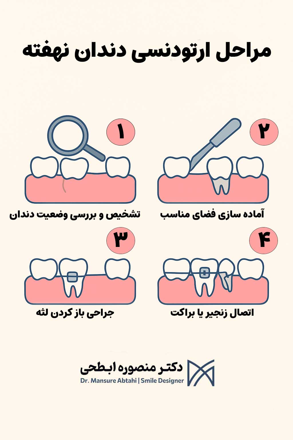 مراحل ارتودنسی دندان نهفته