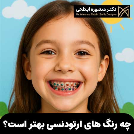 What-orthodontic-colors-are-best