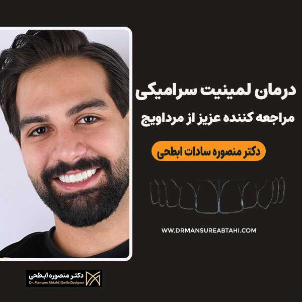 درمان لمینت سرامیکی مراجعه کننده عزیز از مرداویج اصفهان