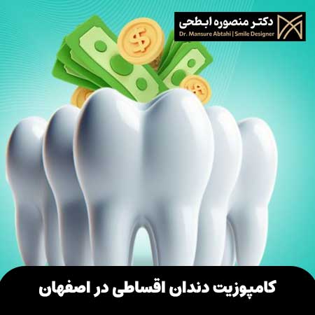کامپوزیت دندان اقساطی در اصفهان