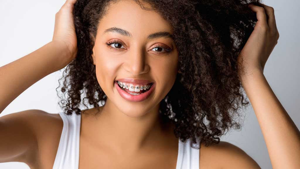 چه رنگ ارتودنسی به پوست سبزه میاد؟