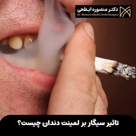 تاثیر سیگار بر لمینت دندان چیست؟