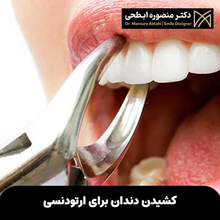 دلایل کشیدن دندان برای ارتودنسی