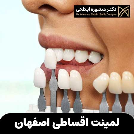 لمینت اقساطی اصفهان