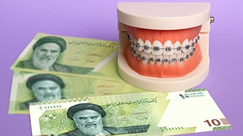 آیا ارتودنسی رایگان در اصفهان وجود دارد؟