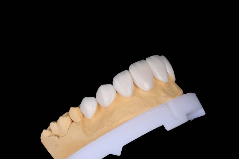 لمینیت سرامیکی در سپاهانشهر اصفهان