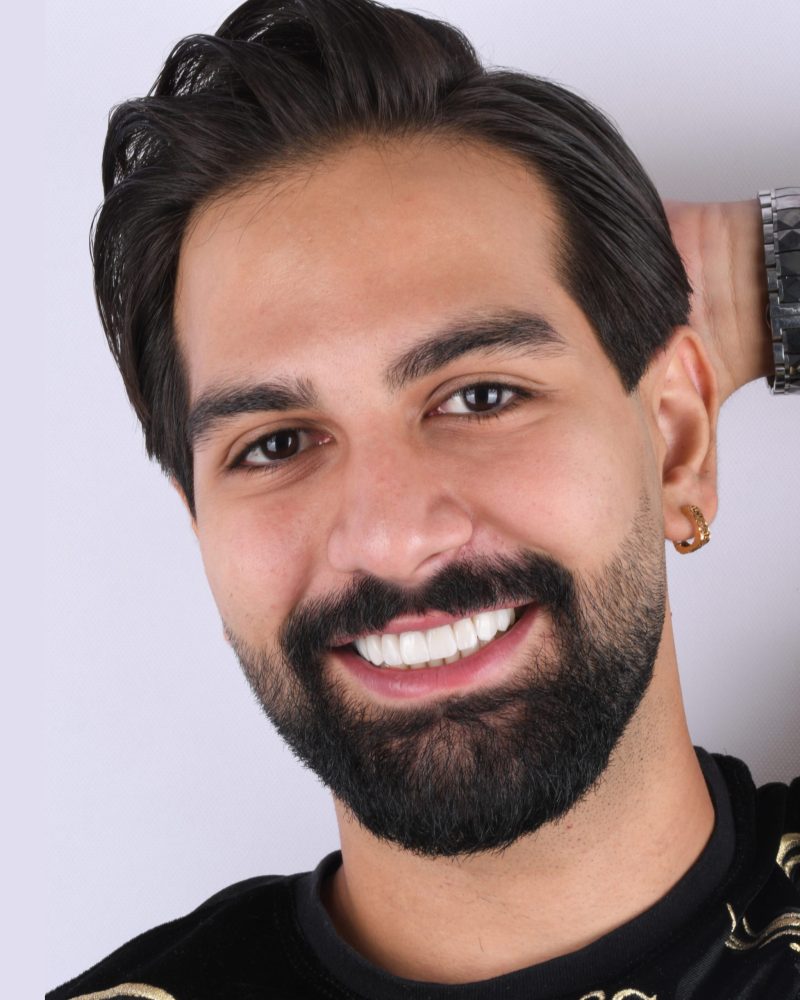 نمونه درمان لمینیت سرامیکی در اصفهان دکتر منصوره سادات ابطحی